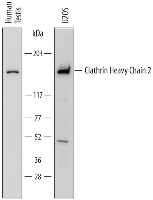 Western Blot Clathrin Heavy Chain 2/CHC22/CLTCL1 Antibody