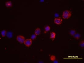 Claudin-12 was detected in immersion fixed NS0 mouse myeloma cell line transfected with human Claudin 12 using 10 µg/mL Mouse Anti-Human Claudin-12 Monoclonal Antibody (Catalog # MAB4284) for 3 hours at room temperature. Cells were stained with the Northern­Lights™ 557-conjugated Anti-Mouse IgG Secondary Antibody (red; Catalog # NL007) and counterstained with DAPI (blue). View our protocol for Fluorescent ICC Staining of Cells on Coverslips.