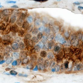 Immunohistochemistry Claudin-19 Antibody (693202)
