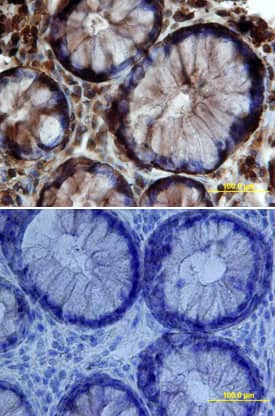 Claudin-3 was detected in immersion fixed paraffin-embedded sections of human colon array using Mouse Anti-Human Claudin-3 Monoclonal Antibody (Catalog # MAB4620) at 15 µg/mL overnight at 4 °C. Tissue was stained using the Anti-Mouse HRP-DAB Cell & Tissue Staining Kit (brown; Catalog # CTS002) and counterstained with hematoxylin (blue). Lower panel shows a lack of labeling if primary antibodies are omitted and tissue is stained only with secondary antibody followed by incubation with detection reagents. View our protocol for Chromogenic IHC Staining of Paraffin-embedded Tissue Sections.