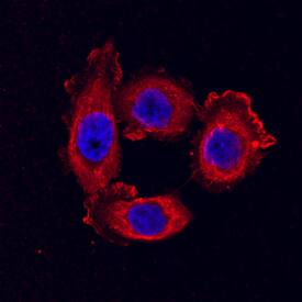 Claudin-3 was detected in immersion fixed PC-3 human prostate cancer cell line using Mouse Anti-Human Claudin-3 Monoclonal Antibody (Catalog # MAB4620) at 10 µg/mL for 3 hours at room temperature. Cells were stained using the NorthernLights™ 557-conjugated Anti-Mouse IgG Secondary Antibody (red; Catalog # NL007) and counterstained with DAPI (blue). Specific staining was localized to cytoplasm. View our protocol for Fluorescent ICC Staining of Cells on Coverslips.