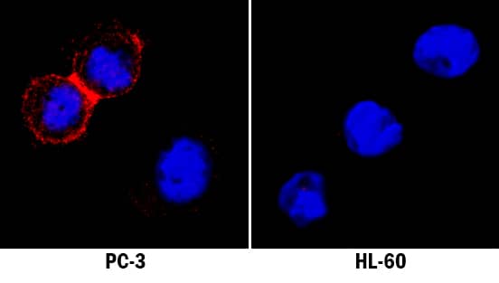 Immunocytochemistry Claudin-4 Antibody (382316) [Unconjugated]