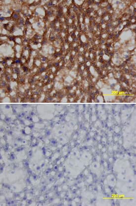 Clusterin was detected in perfusion fixed frozen sections of mouse liver using Goat Anti-Mouse Clusterin Antigen Affinity-purified Polyclonal Antibody (Catalog # AF2747) at 15 µg/mL overnight at 4 °C. Tissue was stained using the Anti-Goat HRP-DAB Cell & Tissue Staining Kit (brown; Catalog # CTS008) and counterstained with hematoxylin (blue). Lower panel shows a lack of labeling if primary antibodies are omitted and tissue is stained only with secondary antibody followed by incubation with detection reagents. View our protocol for Chromogenic IHC Staining of Frozen Tissue Sections.