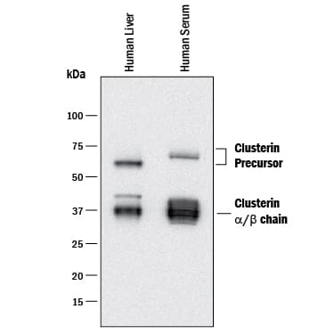 Western Blot Clusterin/APOJ Antibody [Unconjugated]
