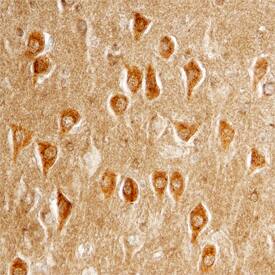 Clusterin was detected in immersion fixed paraffin-embedded sections of human Alzheimer's brain using Sheep Anti-Human Clusterin aa 22-227 Antigen Affinity-purified Polyclonal Antibody (Catalog # AF7084) at 1.7 µg/mL overnight at 4 °C. Tissue was stained using the Anti-Sheep HRP-DAB Cell & Tissue Staining Kit (brown; Catalog # CTS019) and counterstained with hematoxylin (blue). Specific staining was localized to neuronal cell bodies and processes. View our protocol for Chromogenic IHC Staining of Paraffin-embedded Tissue Sections.