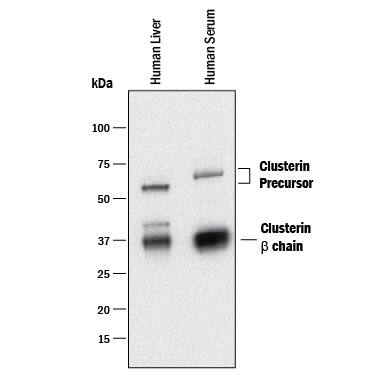 Western blot shows lysates of human liver tissue and human serum. PVDF membrane was probed with 1 µg/mL of Sheep Anti-Human Clusterin aa 22-227 Antigen Affinity-purified Polyclonal Antibody (Catalog # AF7084) followed by HRP-conjugated Anti-Sheep IgG Secondary Antibody (Catalog # HAF016). Specific bands were detected for Clusterin Precursor at approximately 60-65 kDa and Clusterin  beta  chain at approximately 36 kDa (as indicated). This experiment was conducted under reducing conditions and using Immunoblot Buffer Group 1.