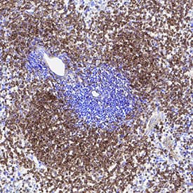 Clusterin was detected in immersion fixed frozen sections of mouse spleen using Mouse Anti-Human Clusterin Monoclonal Antibody (Catalog # MAB29372) at 5 µg/mL for 1 hour at room temperature followed by incubation with the Anti-Mouse IgG VisUCyte™ HRP Polymer Antibody (Catalog # VC001). Tissue was stained using DAB (brown) and counterstained with hematoxylin (blue). Specific staining was localized to cytoplasm. View our protocol for IHC Staining with VisUCyte HRP Polymer Detection Reagents.