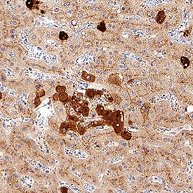 Clusterin was detected in immersion fixed paraffin-embedded sections of human liver using Mouse Anti-Human Clusterin Monoclonal Antibody (Catalog # MAB29372) at 1 µg/mL for 1 hour at room temperature followed by incubation with the Anti-Mouse IgG VisUCyte™ HRP Polymer Antibody (Catalog # VC001). Tissue was stained using DAB (brown) and counterstained with hematoxylin (blue). Specific staining was localized to plasma membrane and cytoplasm. View our protocol for IHC Staining with VisUCyte HRP Polymer Detection Reagents.
