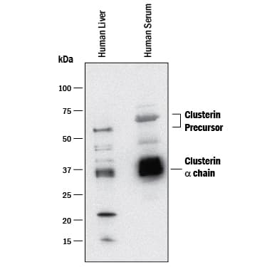 Western Blot Clusterin/APOJ Antibody (350227) [Unconjugated]