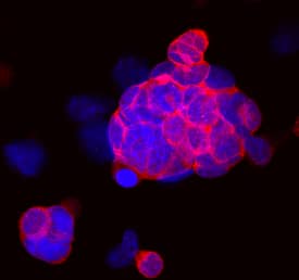 Immunocytochemistry Coactosin-like Protein 1/CotL1 Antibody