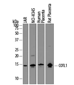 Western Blot Coactosin-like Protein 1/CotL1 Antibody