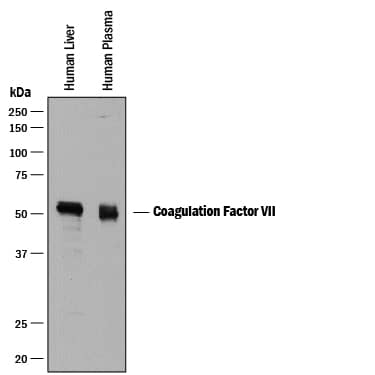 Western Blot Coagulation Factor VII Antibody [Unconjugated]