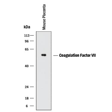 Western blot shows lysate of mouse placenta tissue. PVDF membrane was probed with 1 µg/mL of Goat Anti-Mouse Coagulation Factor VII Antigen Affinity-purified Polyclonal Antibody (Catalog # AF3305) followed by HRP-conjugated Anti-Goat IgG Secondary Antibody (Catalog # HAF017). A specific band was detected for Coagulation Factor VII at approximately 50 kDa (as indicated). This experiment was conducted under reducing conditions and using Immunoblot Buffer Group 1.