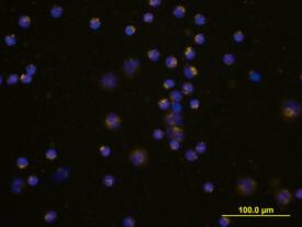 Coagulation Factor VII was detected in immersion fixed human peripheral blood mononuclear cells (PBMCs) using Human Coagulation Factor VII Biotinylated Antigen Affinity-purified Polyclonal Antibody (Catalog # BAF2338) at 10 µg/mL for 3 hours at room temperature. Cells were stained using the NorthernLights™ 557-conjugated Streptavidin (yellow; Catalog # NL999) and counterstained with DAPI (blue). View our protocol for Fluorescent ICC Staining of Non-adherent Cells.