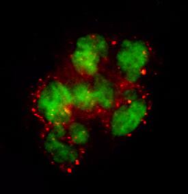 Coagulation Factor VII was detected in immersion fixed PHA-stimulated human peripheral blood mononuclear cells (PBMCs) using 25 &micro;g/mL Mouse Anti-Human Coagulation Factor VII Monoclonal Antibody (Catalog # MAB2338) for 3 hours at room temperature. Cells were stained (red) and counterstained (green). View our protocol for Fluorescent ICC Staining of Non-adherent Cells.