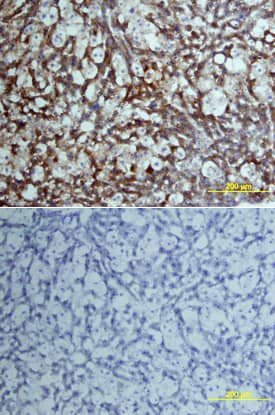 Coagulation Factor VII was detected in perfusion fixed frozen sections of mouse liver using Rat Anti-Mouse Coagulation Factor VII Monoclonal Antibody (Catalog # MAB33051) at 15 µg/mL overnight at 4 °C. Tissue was stained using the Anti-Rat HRP-DAB Cell & Tissue Staining Kit (brown; Catalog # CTS017) and counterstained with hematoxylin (blue). Lower panel shows a lack of labeling if primary antibodies are omitted and tissue is stained only with secondary antibody followed by incubation with detection reagents. View our protocol for Chromogenic IHC Staining of Frozen Tissue Sections.