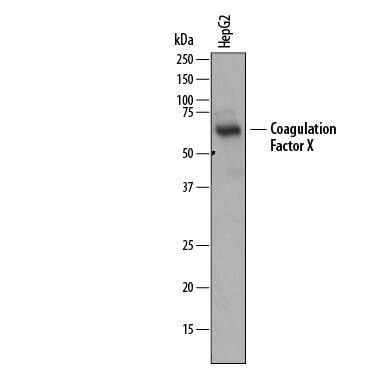Western Blot Coagulation Factor X Antibody