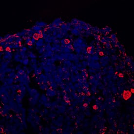 Collagen II was detected in immersion fixed mouse mesenchymal stem cell-differentiated chondrocytes using 10 µg/mL Sheep Anti-Mouse Collagen II Antigen Affinity-purified Polyclonal Antibody (Catalog # AF3615) for 3 hours at room temperature. Cells were stained with the NorthernLights™ 557-conjugated Anti-Sheep IgG Secondary Antibody (red; Catalog # NL010) and counterstained with DAPI (blue). View our protocol for Fluorescent ICC Staining of Cells on Coverslips.