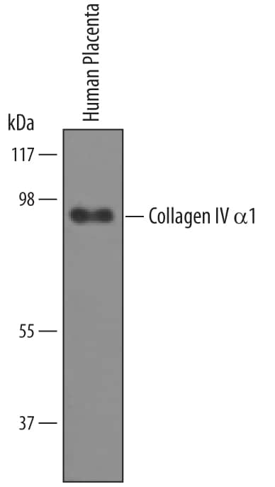 Western blot shows lysates of human placenta tissue. PVDF Membrane was probed with 1 µg/mL of Human Collagen IV a1 Antigen Affinity-purified Polyclonal Antibody (Catalog # AF6308) followed by HRP-conjugated Anti-Sheep IgG Secondary Antibody (HAF016). A specific band was detected for Collagen IV a1 at approximately 95 kDa (as indicated) ref 1. This experiment was conducted under reducing conditions and using Immunoblot Buffer Group 8.
