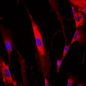 Pro-Collagen I alpha 1 was detected in immersion fixed IMR-90 human lung fibroblast cell line using Sheep Anti-Human Pro-Collagen I alpha 1 Antigen Affinity-purified Polyclonal Antibody (Catalog # AF6220) at 10 µg/mL for 3 hours at room temperature. Cells were stained using the NorthernLights™ 557-conjugated Anti-Sheep IgG Secondary Antibody (red; Catalog # NL010) and counterstained with DAPI (blue). View our protocol for Fluorescent ICC Staining of Cells on Coverslips.