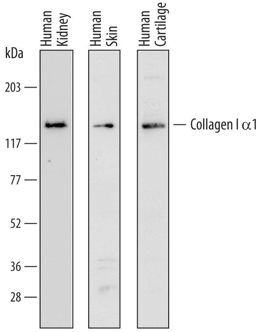 Western blot shows lysates of human kidney tissue, human skin tissue, and human cartilage tissue. PVDF membrane was probed with 1 µg/mL of Sheep Anti-Human Pro-Collagen I alpha 1 Antigen Affinity-purified Polyclonal Antibody (Catalog # AF6220) followed by HRP-conjugated Anti-Sheep IgG Secondary Antibody (Catalog # HAF016). A specific band was detected for Pro-Collagen I alpha 1 at approximately 140 kDa (as indicated). This experiment was conducted under reducing conditions and using Immunoblot Buffer Group 1.