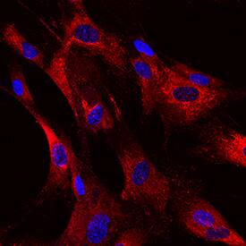 Pro-Collagen I alpha 1 was detected in immersion fixed IMR-90 human lung fibroblast cell line using Mouse Anti-Human Pro-Collagen I alpha 1 Monoclonal Antibody (Catalog # MAB6220) at 10 µg/mL for 3 hours at room temperature. Cells were stained using the NorthernLights™ 557-conjugated Anti-Mouse IgG Secondary Antibody (red; Catalog # NL007) and counterstained with DAPI (blue). Specific staining was localized to cytoplasm. View our protocol for Fluorescent ICC Staining of Cells on Coverslips.