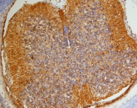 Collagen XIII a1 was detected in immersion fixed frozen sections of mouse embryo (13 d.p.c.) using Sheep Anti-Mouse Collagen XIII a1 Antigen Affinity-purified Polyclonal Antibody (Catalog # AF4627) at 15 µg/mL overnight at 4 °C. Tissue was stained using the Anti-Sheep HRP-DAB Cell & Tissue Staining Kit (brown; Catalog # CTS019) and counterstained with hematoxylin (blue). Specific staining was localized to spinal cord. View our protocol for Chromogenic IHC Staining of Frozen Tissue Sections.