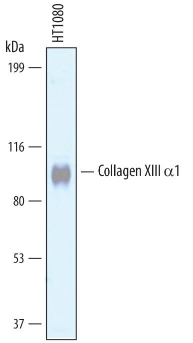 Western blot shows lysates of HT1080 human fibrosarcoma cell line. PVDF membrane was probed with 1 µg/mL of Sheep Anti-Mouse Collagen XIII a1 Antigen Affinity-purified Polyclonal Antibody (Catalog # AF4627) followed by HRP-conjugated Anti-Sheep IgG Secondary Antibody (Catalog # HAF016). A specific band was detected for Collagen XIII a1 at approximately 85-95 kDa (as indicated). This experiment was conducted under reducing conditions and using Immunoblot Buffer Group 1.
