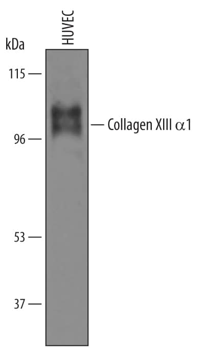 Western blot shows lysates of HUVEC human umbilical vein endothelial cells. PVDF Membrane was probed with 1 µg/mL of Human Collagen XIII a1 Antigen Affinity-purified Polyclonal Antibody (Catalog # AF6346) followed by HRP-conjugated Anti-Sheep IgG Secondary Antibody (Catalog # HAF016). Two specific bands were detected for Collagen XIII a1 at approximately 100 and 110 kDa (as indicated). This experiment was conducted under reducing conditions and using Immunoblot Buffer Group 8.