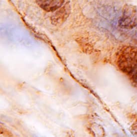 Collagen XIII a1 was detected in immersion fixed paraffin-embedded sections of human placenta using Mouse Anti-Human Collagen XIII a1 Monoclonal Antibody (Catalog # MAB6346) at 15 µg/mL overnight at 4 °C. Tissue was stained using the Anti-Mouse HRP-DAB Cell & Tissue Staining Kit (brown; Catalog # CTS002) and counterstained with hematoxylin (blue). Specific staining was localized to basement membrane. View our protocol for Chromogenic IHC Staining of Paraffin-embedded Tissue Sections.