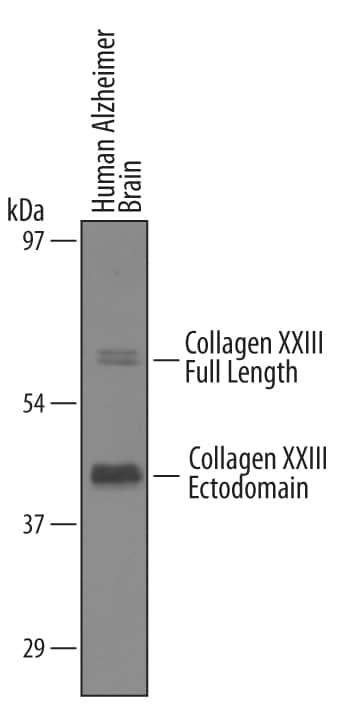 Western blot shows lysates of human alzheimer brain tissue. PVDF membrane was probed with 1 µg/mL of Sheep Anti-Human Collagen XXIII a1 Antigen Affinity-purified Polyclonal Antibody (Catalog # AF4165) followed by HRP-conjugated Anti-Sheep IgG Secondary Antibody (Catalog # HAF016). Specific bands were detected for Collagen XXIII a1 at approximately 45 and 70 kDa (as indicated). This experiment was conducted under reducing conditions and using Immunoblot Buffer Group 8.