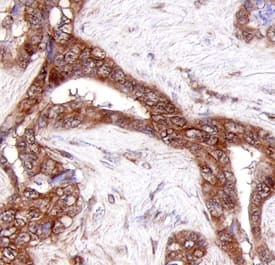 Immunohistochemistry Collagen XXIII alpha 1 Antibody (468642) [Unconjugated]