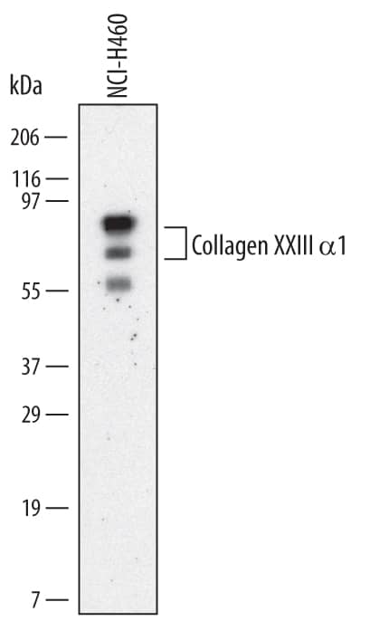 Western Blot Collagen XXIII alpha 1 Antibody (468642) [Unconjugated]