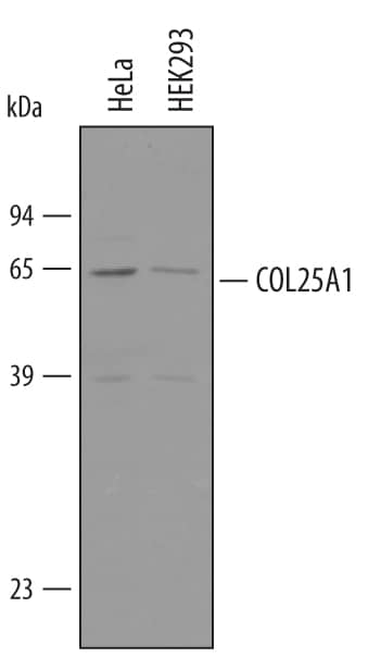 Western Blot Collagen XXV alpha 1 Antibody