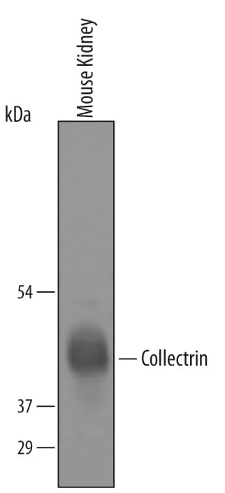 Western Blot Collectrin/TMEM27 Antibody [Unconjugated]