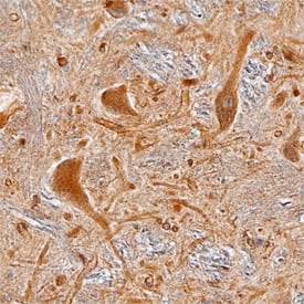 Immunohistochemistry Collybistin/ARHGEF9 Antibody (809309) [Unconjugated]