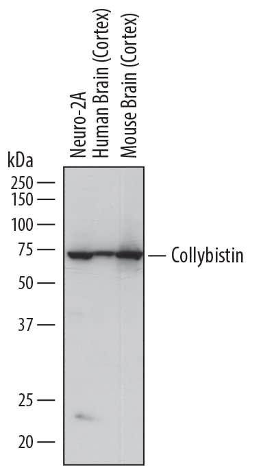 Western Blot Collybistin/ARHGEF9 Antibody (809309) [Unconjugated]