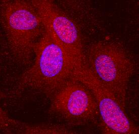 Immunocytochemistry Complement Component C1qC Antibody [Unconjugated]