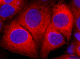 Complement Component C3a was detected in immersion fixed HepG2 human hepatocellular carcinoma cell line using Goat Anti-Human Complement Component C3a Antigen Affinity-purified Polyclonal Antibody (Catalog # AF3677) at 10 µg/mL for 3 hours at room temperature. Cells were stained using the NorthernLights™ 557-conjugated Anti-Goat IgG Secondary Antibody (red; Catalog # NL001) and counterstained with DAPI (blue). Specific staining was localized to cytoplasm. View our protocol for Fluorescent ICC Staining of Cells on Coverslips.