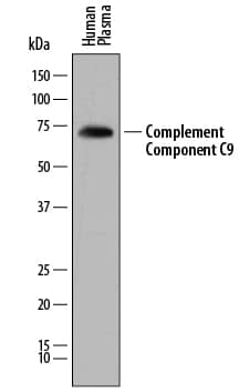 Western blot shows lysates of human plasma. PVDF membrane was probed with 0.2 µg/mL of Sheep Anti-Human Complement Component C9 Antigen Affinity-purified Polyclonal Antibody (Catalog # AF8126) followed by HRP-conjugated Anti-Sheep IgG Secondary Antibody (Catalog # HAF016). A specific band was detected for Complement Component C9 at approximately 70 kDa (as indicated). This experiment was conducted under reducing conditions and using Immunoblot Buffer Group 1.