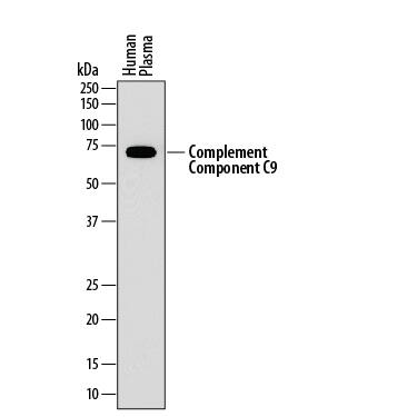 Western Blot Complement Component C9 Antibody (887025) [Unconjugated]