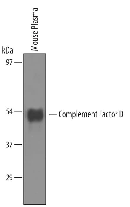 Western blot shows lysates of mouse plasma. PVDF membrane was probed with 1 µg/mL of Sheep Anti-Mouse Complement Factor D/Adipsin Antigen Affinity-purified Polyclonal Antibody (Catalog # AF5430) followed by HRP-conjugated Anti-Sheep IgG Secondary Antibody (Catalog # HAF016). A specific band was detected for Complement Factor D/Adipsin at approximately 45kDa (as indicated). This experiment was conducted under reducing conditions and using Immunoblot Buffer Group 8.