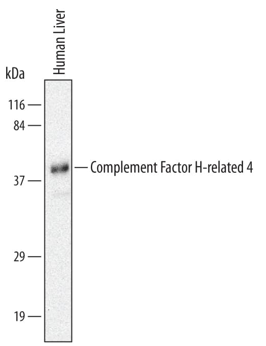 Western Blot Complement Factor H-related 4/CFHR4 Antibody (640212) [Unconjugated]