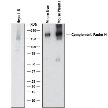 Western blot shows lysates of Hepa 1-6 mouse hepatoma cell line, mouse liver tissue, and mouse plasma. PVDF membrane was probed with 1 µg/mL of Sheep Anti-Mouse Complement Factor H Antigen Affinity-purified Polyclonal Antibody (Catalog # AF4999) followed by HRP-conjugated Anti-Sheep IgG Secondary Antibody (Catalog # HAF016). A specific band was detected for Complement Factor H at approximately 150 kDa (as indicated). This experiment was conducted under reducing conditions and using Immunoblot Buffer Group 1.