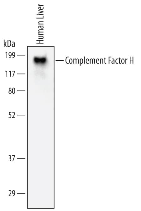 Western blot shows lysates of human liver tissue. PVDF Membrane was probed with 2 µg/mL of Human Complement Factor H Monoclonal Antibody (Catalog # MAB4779) followed by HRP-conjugated Anti-Mouse IgG Secondary Antibody (Catalog # HAF007). A specific band was detected for Complement Factor H at approximately 155 kDa (as indicated). This experiment was conducted under non-reducing conditions and using Immunoblot Buffer Group 1.