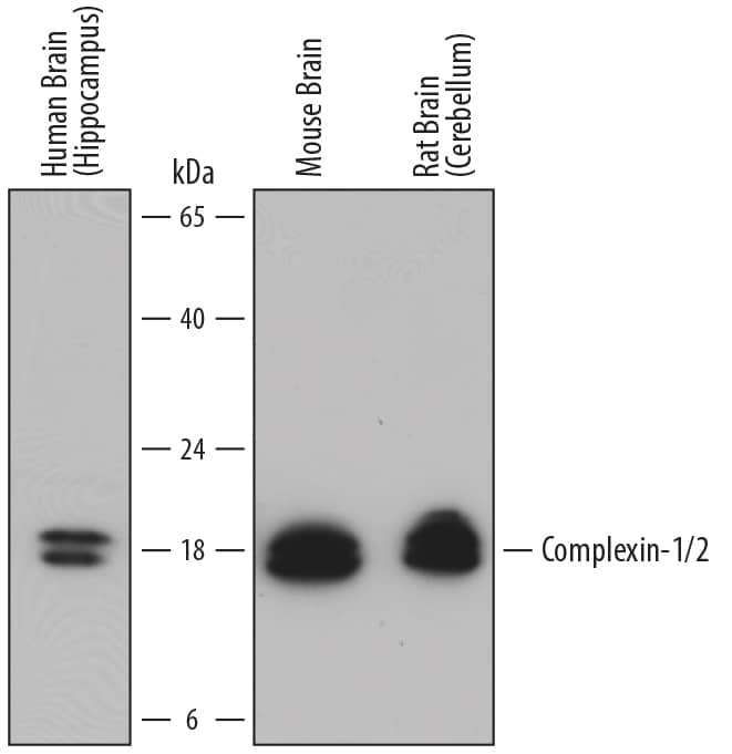 Western blot shows lysates of human brain (hippocampus) tissue, mouse brain tissue, and rat brain (cerebellum) tissue. PVDF membrane was probed with 0.5 µg/mL of Goat Anti-Human/Mouse/Rat Complexin-1/2 Antigen Affinity-purified Polyclonal Antibody (Catalog # AF7787) followed by HRP-conjugated Anti-Goat IgG Secondary Antibody (Catalog # HAF017). Specific bands were detected for Complexin-1/2 at approximately 17-19 kDa (as indicated). This experiment was conducted under reducing conditions and using Immunoblot Buffer Group 1.
