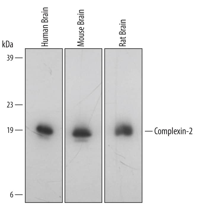Western Blot Complexin-2 Antibody [Unconjugated]