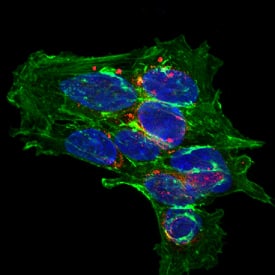 Immunocytochemistry Complexin-2 Antibody [Unconjugated]