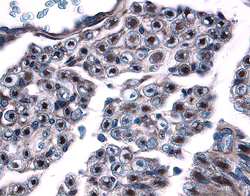 Contactin-1 was detected in immersion fixed paraffin-embedded sections of human dorsal root ganglia using 15 µg/mL Goat Anti-Human/ Mouse/Rat Contactin-1 Antigen Affinity-purified Polyclonal Antibody (Catalog # AF904) overnight at 4 °C. Tissue was stained with the Anti-Goat HRP-DAB Cell & Tissue Staining Kit (brown; Catalog # CTS008) and counterstained with hematoxylin (blue). View our protocol for Chromogenic IHC Staining of Paraffin-embedded Tissue Sections.