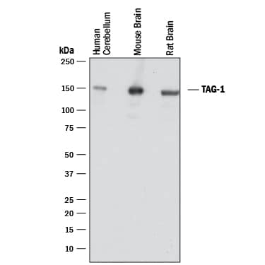 Western Blot Contactin-2/TAG1 Antibody [Unconjugated]